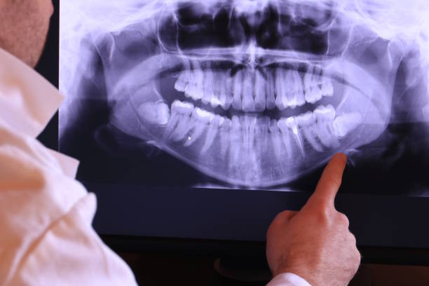 Best Emergency Treatment for Dental Infections or Abscesses in South Hempstead, NY